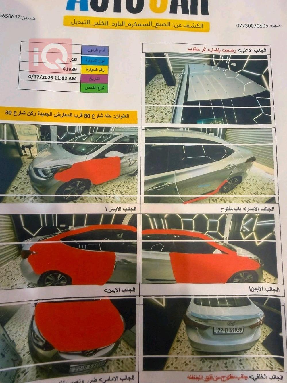 هيونداي النترا